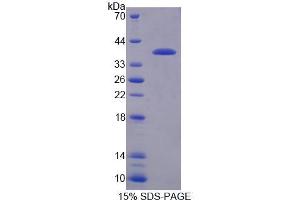SDS-PAGE (SDS) image for Regulator of G-Protein Signaling 9 (RGS) (AA 1-296) protein (His tag) (ABIN6239415)
