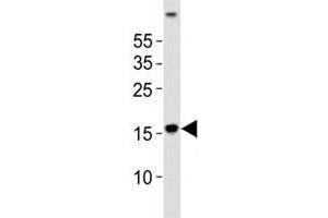 Western blot analysis of lysate from human brain tissue using LC3A antibody diluted at 1:1000. (MAP1LC3A anticorps  (N-Term))