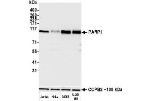 Western Blotting (WB) image for anti-Poly (ADP-Ribose) Polymerase 1 (PARP1) (AA 750-800) antibody (ABIN7449457)