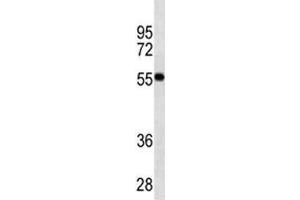 VDR antibody western blot analysis in MDA-MB453 lysate.
