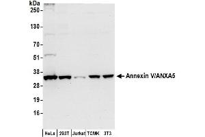 Western Blotting (WB) image for anti-Annexin A5 (ANXA5) (AA 100-150) antibody (ABIN7453030)
