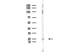 anti-Adenylate Kinase 5 (AK5) (N-Term) antibody