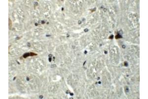 Immunohistochemistry (IHC) image for anti-RAB Guanine Nucleotide Exchange Factor (GEF) 1 (RABGEF1) (C-Term) antibody (ABIN1030611)