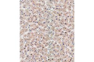 Immunohistochemical analysis of paraffin-embedded human liver tissue using (ABIN388518 and ABIN2849631) performed on the Leica® BOND RXm. (ATG5 anticorps  (N-Term))