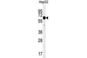 IGF2BP2 Antibody (C-term) western blot analysis in HepG2 cell line lysates (35µg/lane). (IGF2BP2 anticorps  (C-Term))