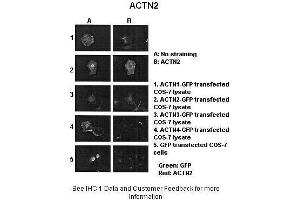 Sample Type :  ACTNX-GFP transfected COS-7 cells  Primary Antibody Dilution :  1:1000  Secondary Antibody :  Anti-rabbit-Alexa-Fluor 568  Secondary Antibody Dilution :  1:100  Color/Signal Descriptions :  Green: GFP Red: ACTN2  Gene Name :  ACTN2  Submitted by :  Johannes W.