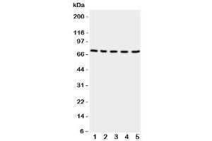 Western blot testing of NRG1 antibody and Lane 1: rat spleen (Neuregulin 1 anticorps  (C-Term))