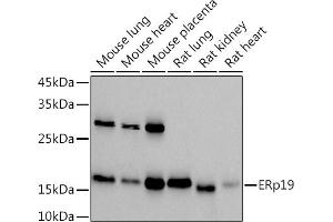 Western blot analysis of extracts of various cell lines, using (ABIN7270799) at 1:1000 dilution. (TXNDC12 anticorps)
