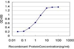 Detection limit for recombinant GST tagged PGR is approximately 0. (Progesterone Receptor anticorps  (AA 1-110))