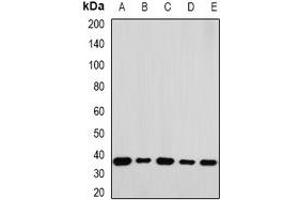 Western blot analysis of RPLP0 expression in A549 (A), K562 (B), Jurkat (C), mouse liver (D), mouse testis (E) whole cell lysates. (RPLP0 anticorps)