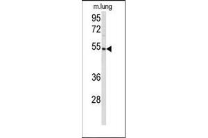 Image no. 1 for anti-Prostaglandin I2 (Prostacyclin) Synthase (PTGIS) (N-Term) antibody (ABIN360419)