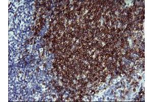 Image no. 1 for anti-CD22 Molecule (CD22) antibody (ABIN1497211)