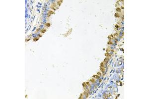 Immunohistochemistry of paraffin-embedded mouse lung using KLK11 antibody (ABIN5975048) at dilution of 1/100 (40x lens). (Kallikrein 11 anticorps)