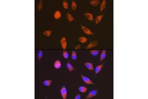 Immunofluorescence analysis of HeLa cells using LGR6 Rabbit mAb (ABIN7268235) at dilution of 1:100 (40x lens).