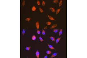 Immunofluorescence analysis of HeLa cells using LGR6 Rabbit mAb (ABIN7268235) at dilution of 1:100 (40x lens). (LGR6 anticorps)
