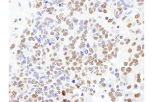 Immunohistochemistry (IHC) image for anti-Splicing Factor 1 (SF1) (AA 25-75) antibody (ABIN7453644) (Splicing Factor 1 anticorps  (AA 25-75))