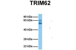 Host:  Rabbit  Target Name:  TRIM62  Sample Tissue:  Human Ovary Tumor  Antibody Dilution:  1. (TRIM62 anticorps  (N-Term))