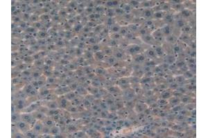 IHC-P analysis of Mouse Liver Tissue, with DAB staining. (IGFBP7 anticorps  (AA 88-281))