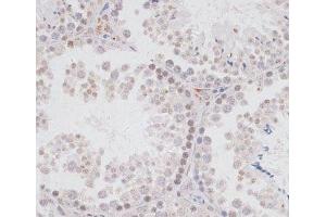 Immunohistochemistry of paraffin-embedded Mouse testis using KDM3A Polyclonal Antibody at dilution of 1:100 (40x lens). (KDM3A anticorps)