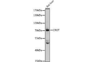 Western blot analysis of extracts of rat liver, using CROT antibody (ABIN1679365, ABIN3019208, ABIN3019209 and ABIN6220764) at 1:3000 dilution. (CROT anticorps  (AA 1-87))