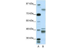 ZNF607 antibody used at 0. (ZNF607 anticorps  (Middle Region))