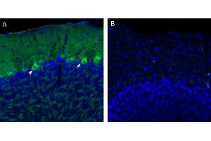 Free-floating frozen brain sections from a paraformaldehyde-perfused mouse were incubated with Anti-Endothelin Receptor A (extracellular) Antibody (ABIN7581867, 1:300), followed by goat anti-rabbit secondary antibody conjugated to Alexa Fluor® 488 (green).