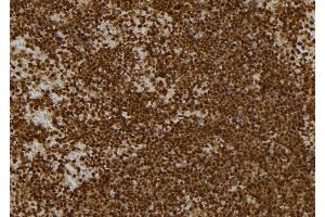 ABIN6277134 at 1/100 staining Mouse spleen tissue by IHC-P. (KBTBD3 anticorps  (C-Term))