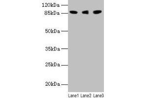 Western blot All lanes: Loxl2 antibody at 14 μg/mL Lane 1: 293T whole cell lysate Lane 2: A549 whole cell lysate Lane 3: A431 whole cell lysate Secondary Goat polyclonal to rabbit IgG at 1/10000 dilution Predicted band size: 88, 82 kDa Observed band size: 88 kDa (LOXL2 anticorps  (AA 26-776))