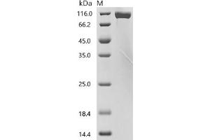 (Tris-Glycine gel) Discontinuous SDS-PAGE (reduced) with 5 % enrichment gel and 15 % separation gel.