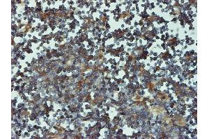 Immunoperoxidase of monoclonal antibody to PSMB6 on formalin-fixed paraffin-embedded human lymph node tissue.