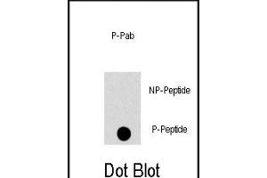 Dot blot analysis of anti-PK8-p Phospho-specific Pab (ABIN389822 and ABIN2839706) on nitrocellulose membrane. (JNK anticorps  (pThr183))