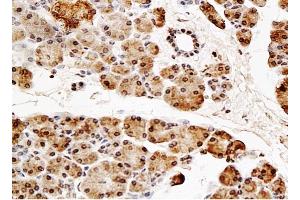 Formalin-fixed and paraffin embedded rat pancreas tissue labeled with Anti-NT5C2 Polyclonal Antibody, Unconjugated (ABIN739353) onjugated