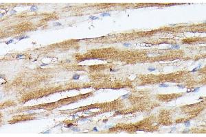 Immunohistochemistry of paraffin-embedded Rat heart using NUBP1 Polyclonal Antibody at dilution of 1:100 (40x lens). (NUBP1 anticorps)