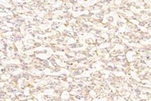 Immunohistochemistry analysis of paraffin-embedded rat placenta using,PTGFR (ABIN7075209) at dilution of 1: 800 (PTGFR anticorps)
