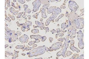 IHC analysis of ACKR2 using anti-ACKR2 antibody (ABIN6719286). (CCBP2 anticorps  (AA 138-384))