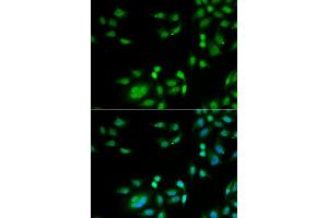 Immunofluorescence analysis of A549 cell using INTS10 antibody. (INTS10 anticorps)