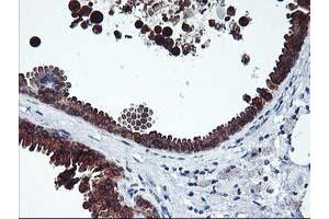 anti-Integrin alpha FG-GAP Repeat Containing 2 (ITFG2) antibody
