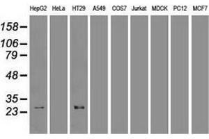 Western blot analysis of extracts (35 µg) from 9 different cell lines by using anti-HHex monoclonal antibody. (HHEX anticorps  (AA 100-270))