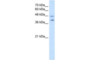 Western Blotting (WB) image for anti-Pregnancy Specific beta-1-Glycoprotein 1 (PSG1) antibody (ABIN2462567) (PSG1 anticorps)