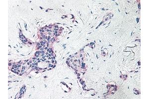 Image no. 6 for anti-Platelet Factor 4 (PF4) antibody (ABIN465152) (PF4 anticorps)