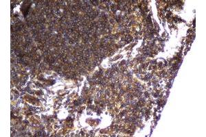 Image no. 1 for anti-Coiled-Coil Domain Containing 93 (CCDC93) (AA 293-631) antibody (ABIN1491348)