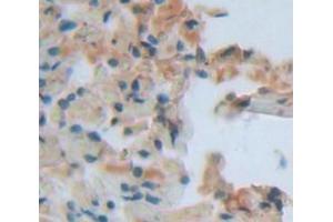 IHC-P analysis of Human Tissue, with DAB staining. (Calmodulin 1 anticorps  (AA 1-149))
