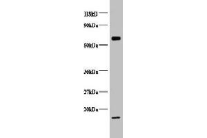 Western blot All lanes: COX5B antibody at 2 μg/mL + EC109 whole cell lysate Secondary Goat polyclonal to rabbit IgG at 1/15000 dilution Predicted band size: 14 kDa Observed band size: 14, 65 kDa (COX5B anticorps  (AA 32-129))
