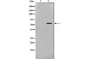 Western blot analysis of Src expression in 293 whole cell lysates,The lane on the left is treated with the antigen-specific peptide. (Src anticorps)