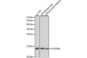 Western blot analysis of extracts of various cell lines using PLA2G1B Polyclonal Antibody at dilution of 1:1000. (PLA2G1B anticorps)