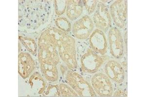 Immunohistochemistry of paraffin-embedded human kidney tissue using ABIN7171149 at dilution of 1:100 (SNAP29 anticorps  (AA 1-258))