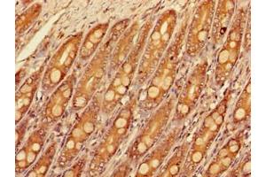 Immunohistochemistry of paraffin-embedded human small intestine tissue using ABIN7160177 at dilution of 1:100 (SLC16A9 anticorps  (AA 185-304))