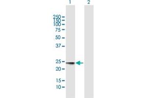 Western Blot analysis of MED18 expression in transfected 293T cell line by MED18 MaxPab polyclonal antibody. (MED18 anticorps  (AA 1-208))