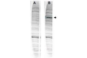 Image no. 2 for anti-Werner Helicase Interacting Protein 1 (WRNIP1) (Internal Region) antibody (ABIN401271) (WRNIP1 anticorps  (Internal Region))