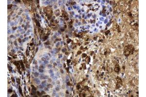 Image no. 4 for anti-Thymidine Phosphorylase (TYMP) (AA 311-482) antibody (ABIN1491396)